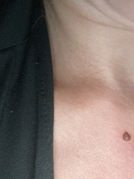 Help- mole looking dry