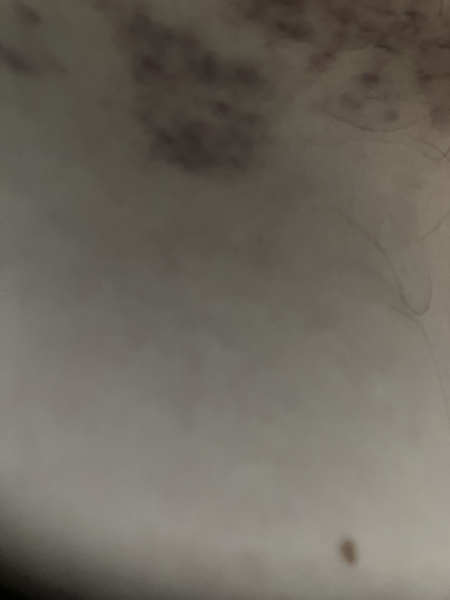 Bikini wax
