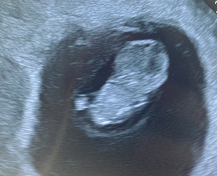 Due February 2025 - Thread 2