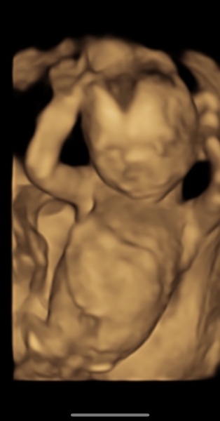 Gender scan - definitely a boy?