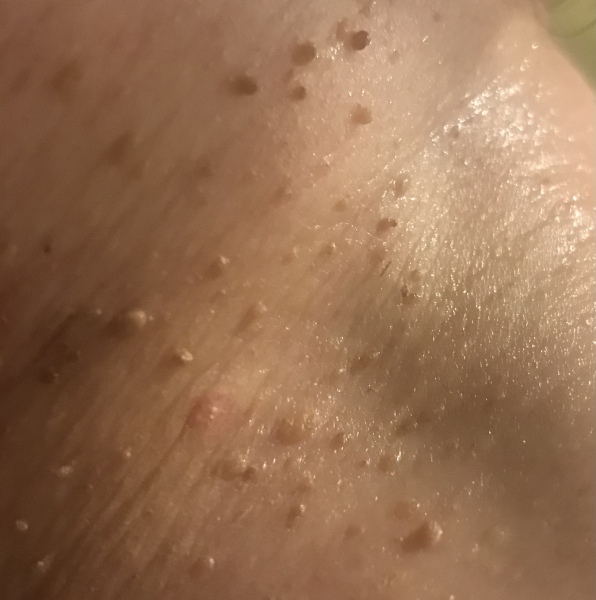 Any beauty therapists / dermatologists around? I need help!