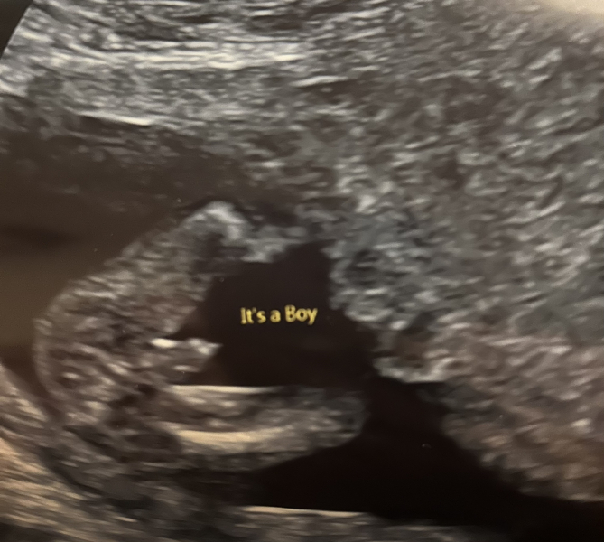 Is this really a boy? Gender suspicion.