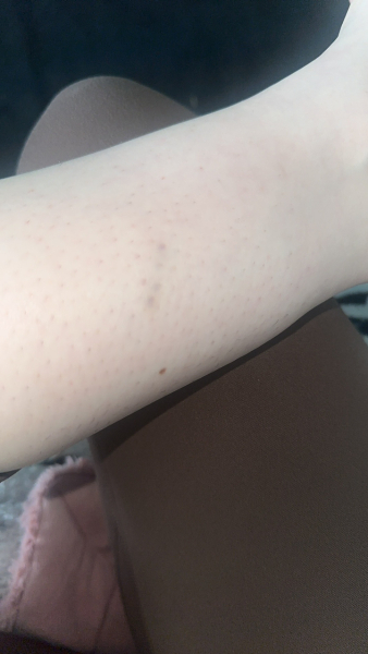 What is this??? - health