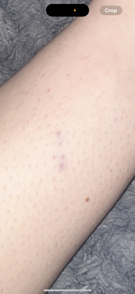 What is this??? - health