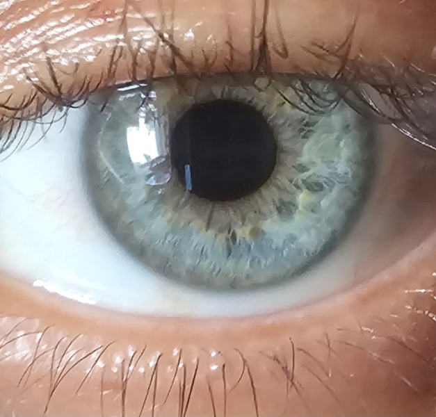 Settle an eye colour debate for me please?