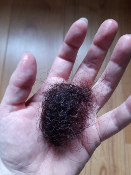 Excessive hair loss?