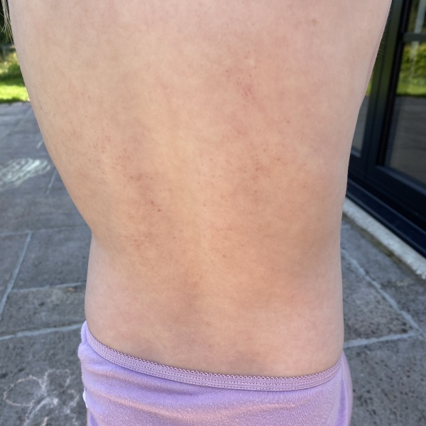 Could this rash be an autoimmune thing? Please help!