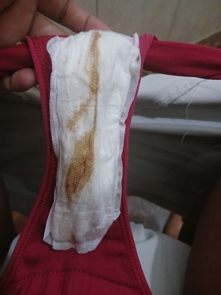 Is this implantation bleeding or just spotting?