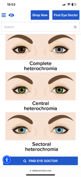 Eye colour