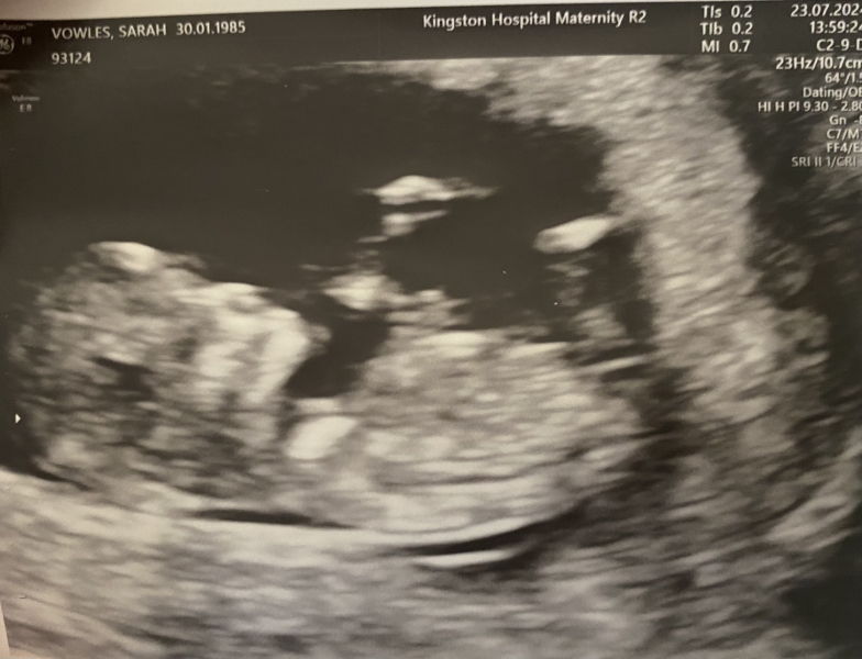 Due February 2025 - Thread 2