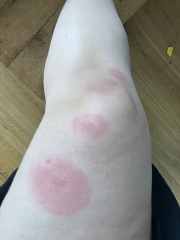 Bullseye bites?