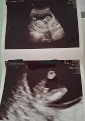 Definitely a boy ??