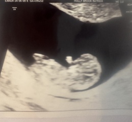 Any guesses, boy or girl? 12 week scan