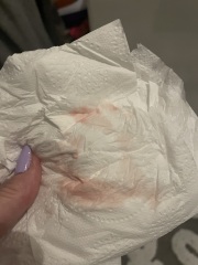 TMI pics ** bleeding after a positive test