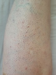 Help me and my ugly legs