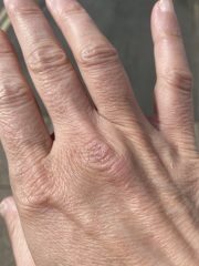 WWYD with this (pic)