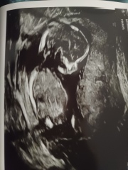 Do you want me to guess the sex? 12 week scans.