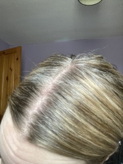 Hair crisis
