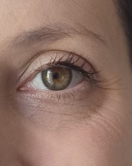 Fine lines and crows feet around eyes