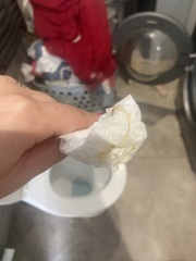 BFP after recent loss