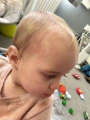 possible allergy?