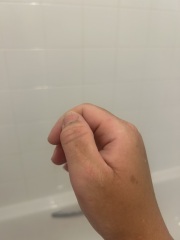 Does this look like bad fake tan?