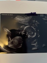 Nub theory 12 and 20 weeks