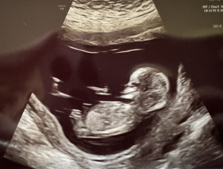 Nub theory?