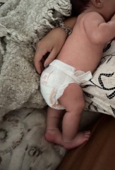 Femur length only on 5th percentile - should I be worried?