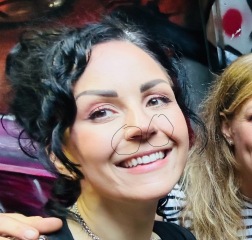 Gummy Smile Botox problem - pic included.