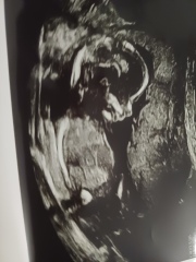Do you want me to guess the sex? 12 week scans.