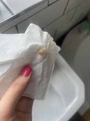 Spotting or not? 🤔