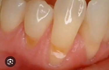 To be worried and upset about the state of my teeth