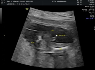 Is this really a boy?!