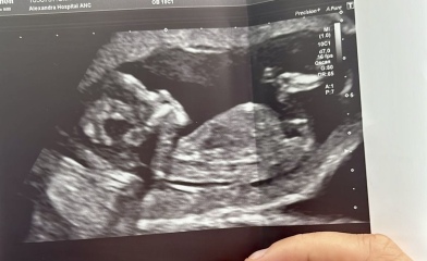 Anyone experienced with looking at ultrasound? Concerns…
