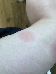 Bullseye bites?
