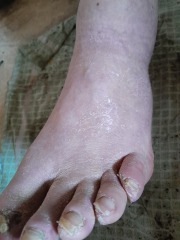 Best way to remove dead skin/keep feet smooth?