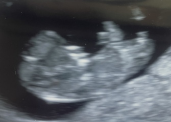 Boy or girl ?