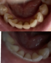 The dental polisher thing - I can't find the thread.