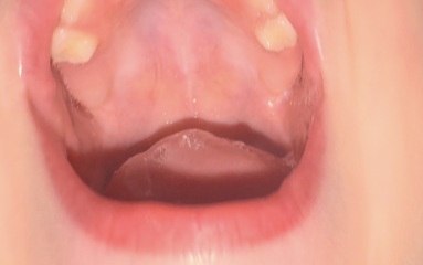 Teething toddler? Second molars? Experiences?!