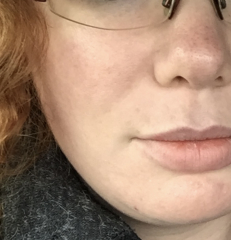 I'm confused, dermatica/skin & me
