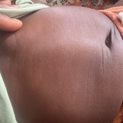 Baby skin