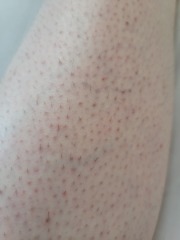 Help me and my ugly legs