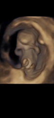 4d scan at nearly 11 weeks