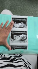boy or girl