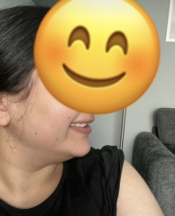 Honest thoughts on my smile