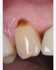 To be worried and upset about the state of my teeth