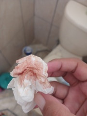 Is this implantation bleeding or just spotting?