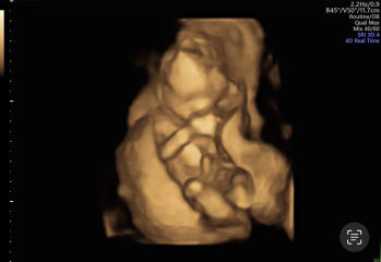 BFP after IVF - the journey continues (part 2)