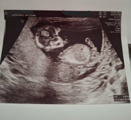 Definitely a boy ??